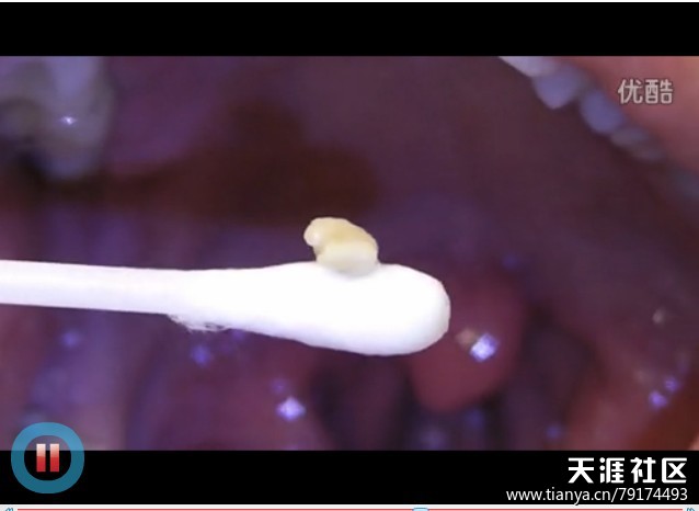 【星空娱乐官方下载】具滋哲与奥格斯堡续约(图3) 星空娱乐